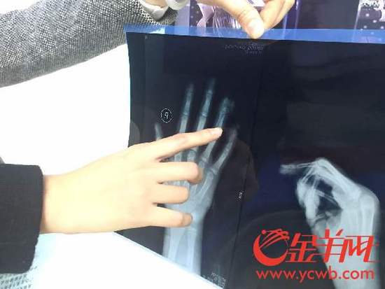 С�^(q��)�������ĊA��ָ����С��ָ�Ǳ��A���� 