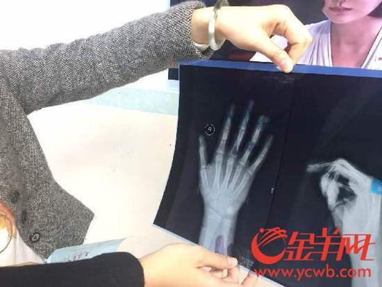 С�^(q��)�������ĊA��ָ����С��ָ�Ǳ��A���� 